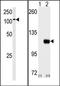 Hexokinase-1 antibody, AP15129PU-N, Origene, Western Blot image 