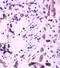 V-Set Domain Containing T Cell Activation Inhibitor 1 antibody, orb10163, Biorbyt, Immunohistochemistry paraffin image 