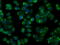Nitrilase homolog 1 antibody, GTX84042, GeneTex, Immunofluorescence image 