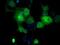GLGB antibody, NBP2-02245, Novus Biologicals, Immunofluorescence image 