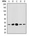 Centrosomal Protein 44 antibody, abx141471, Abbexa, Western Blot image 