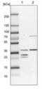 Short-chain dehydrogenase/reductase 3 antibody, NBP1-80846, Novus Biologicals, Western Blot image 