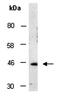 Lysine Demethylase 4C antibody, orb67178, Biorbyt, Western Blot image 