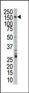 Pre-MRNA Processing Factor 4B antibody, PA5-14485, Invitrogen Antibodies, Western Blot image 