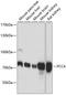 Propionyl-CoA Carboxylase Subunit Alpha antibody, A03395, Boster Biological Technology, Western Blot image 