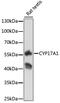 Cyp17 antibody, 15-168, ProSci, Western Blot image 
