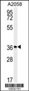 Major Facilitator Superfamily Domain Containing 3 antibody, 61-854, ProSci, Western Blot image 