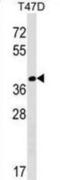 N-Terminal Asparagine Amidase antibody, abx029762, Abbexa, Western Blot image 