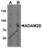 ADAM Metallopeptidase Domain 29 antibody, 8183, ProSci, Western Blot image 