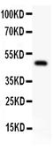 Transcription Factor AP-2 Alpha antibody, PB9118, Boster Biological Technology, Western Blot image 