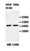 Olfactomedin 2 antibody, orb77689, Biorbyt, Western Blot image 