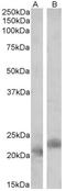PYCARD antibody, AP32825PU-N, Origene, Western Blot image 