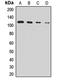 Arf-GAP with GTPase, ANK repeat and PH domain-containing protein 2 antibody, orb412130, Biorbyt, Western Blot image 