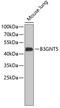 UDP-GlcNAc:betaGal beta-1,3-N-acetylglucosaminyltransferase 5 antibody, 19-086, ProSci, Western Blot image 