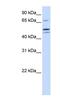Glutamyl-TRNA Synthetase 2, Mitochondrial antibody, NBP1-56400, Novus Biologicals, Western Blot image 