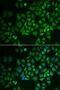 Glycosylphosphatidylinositol Specific Phospholipase D1 antibody, LS-C334829, Lifespan Biosciences, Immunofluorescence image 