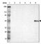 H/ACA ribonucleoprotein complex subunit 4 antibody, NBP1-85156, Novus Biologicals, Western Blot image 