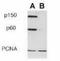 Chromatin assembly factor 1 subunit B antibody, TA301488, Origene, Western Blot image 
