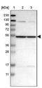 Carbohydrate sulfotransferase 15 antibody, NBP1-88367, Novus Biologicals, Western Blot image 