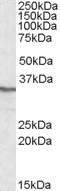 Protein Phosphatase 4 Catalytic Subunit antibody, orb20241, Biorbyt, Western Blot image 