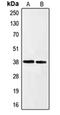 Ephrin A3 antibody, orb213874, Biorbyt, Western Blot image 