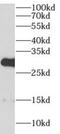 Androgen Induced 1 antibody, FNab00237, FineTest, Western Blot image 