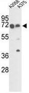 FKBP Prolyl Isomerase 10 antibody, GTX81486, GeneTex, Western Blot image 