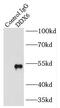 DEAD-Box Helicase 6 antibody, FNab02319, FineTest, Immunoprecipitation image 