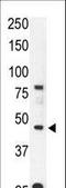 C-C Motif Chemokine Receptor 9 antibody, LS-C97666, Lifespan Biosciences, Western Blot image 
