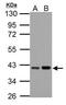 Enoyl-CoA Delta Isomerase 2 antibody, PA5-34898, Invitrogen Antibodies, Western Blot image 