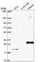 CCAAT Enhancer Binding Protein Beta antibody, NBP2-57075, Novus Biologicals, Western Blot image 