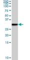 TGFB Induced Factor Homeobox 2 antibody, H00060436-M01, Novus Biologicals, Western Blot image 