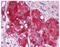 LY6/PLAUR Domain Containing 3 antibody, NBP1-44371, Novus Biologicals, Immunohistochemistry frozen image 