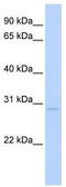 Nuclear Receptor Subfamily 0 Group B Member 2 antibody, TA339537, Origene, Western Blot image 