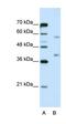 Heterogeneous Nuclear Ribonucleoprotein A3 antibody, orb324946, Biorbyt, Western Blot image 