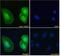 T-lymphoma invasion and metastasis-inducing protein 1 antibody, NBP2-75096, Novus Biologicals, Immunofluorescence image 