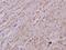 Collagen Type IV Alpha 2 Chain antibody, A02453, Boster Biological Technology, Immunohistochemistry paraffin image 