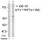 Insulin Like Growth Factor 1 Receptor antibody, AP02386PU-N, Origene, Western Blot image 