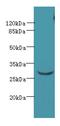 Coiled-Coil Domain Containing 127 antibody, A58470-100, Epigentek, Western Blot image 