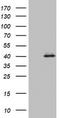 Ornithine Carbamoyltransferase antibody, TA802731S, Origene, Western Blot image 