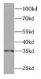 Geranylgeranyl Diphosphate Synthase 1 antibody, FNab03445, FineTest, Western Blot image 