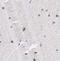 2'-5'-Oligoadenylate Synthetase 3 antibody, FNab05952, FineTest, Immunohistochemistry frozen image 