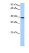 Mitochondrial RRNA Methyltransferase 1 antibody, NBP1-57366, Novus Biologicals, Western Blot image 