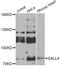 Spalt Like Transcription Factor 4 antibody, STJ29204, St John