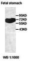 Polypeptide N-Acetylgalactosaminyltransferase 7 antibody, orb77574, Biorbyt, Western Blot image 