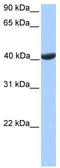 Phosphoglycerate kinase 2 antibody, TA335403, Origene, Western Blot image 