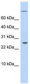 AT-Rich Interaction Domain 5A antibody, TA339228, Origene, Western Blot image 