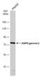 Protein Kinase AMP-Activated Non-Catalytic Subunit Gamma 2 antibody, GTX114178, GeneTex, Western Blot image 