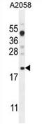 Variable Charge X-Linked antibody, AP54502PU-N, Origene, Western Blot image 