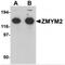 Zinc Finger MYM-Type Containing 2 antibody, MBS151573, MyBioSource, Western Blot image 